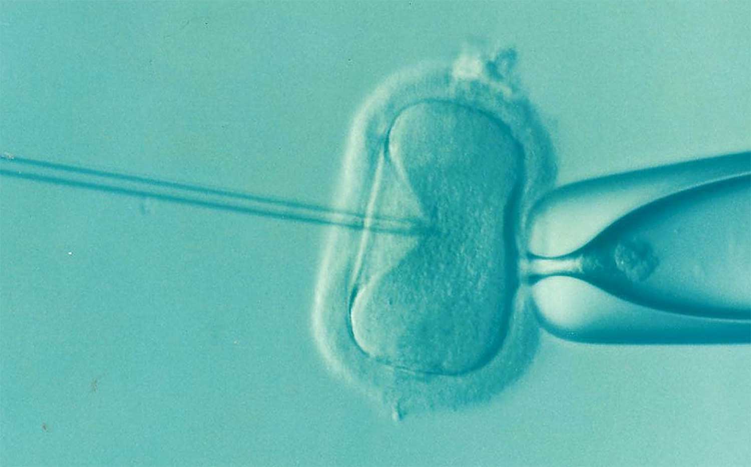 eicel-bevruchting-ivf