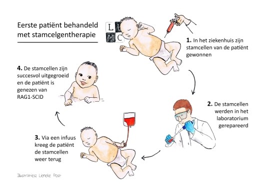  stamcelgentherapie