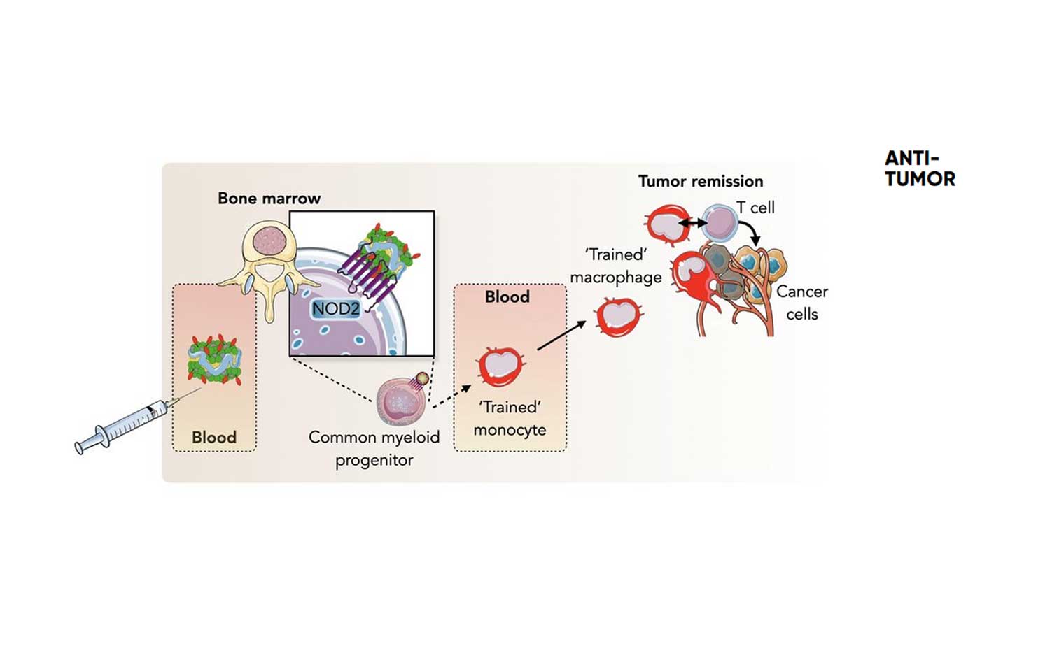 tumor-immuun