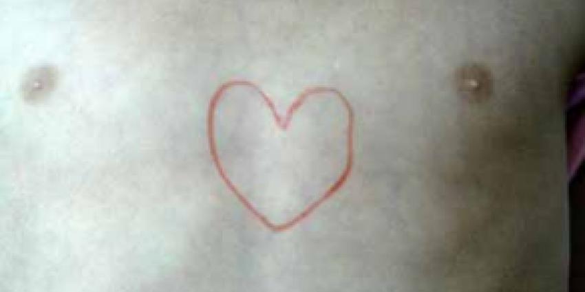 Hartpatiënten Nederland ernstig bezorgd om wurgcontracten met ziekenhuizen