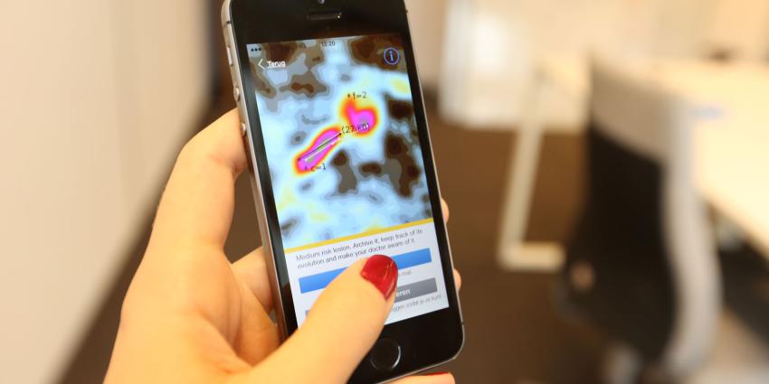 Gratis advies dermatoloog op Huidkankerdag via zelf-check app