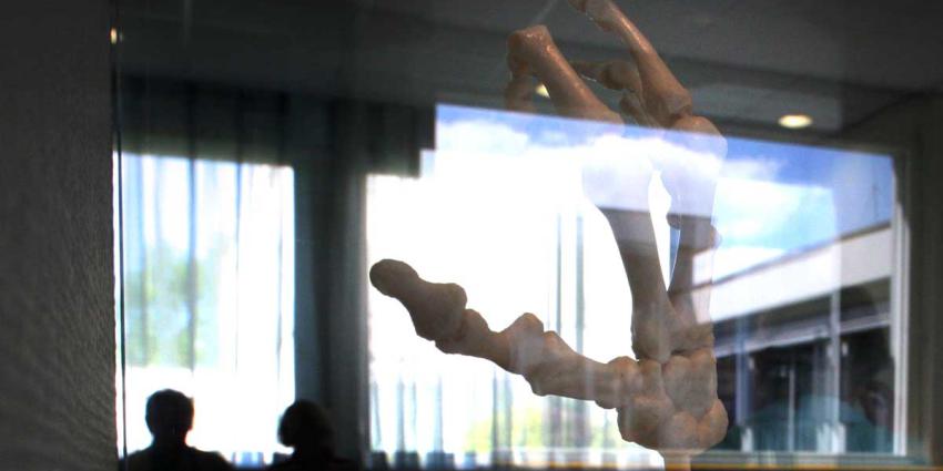 botjes-artrose-hand-ziekenh