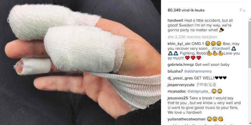 Dj Hardwell heeft een ongelukje gehad