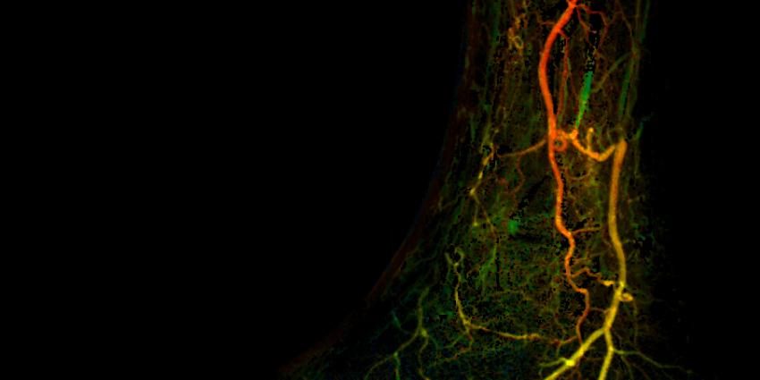 Samenwerking Philips en AMC voor betere behandeling diabetische voeten 