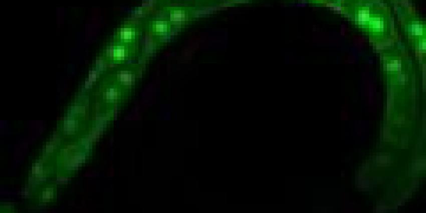 NWO-onderzoekers ontdekken sterke rem op celdeling