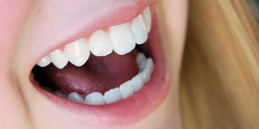 Foto van tanden | Sxc