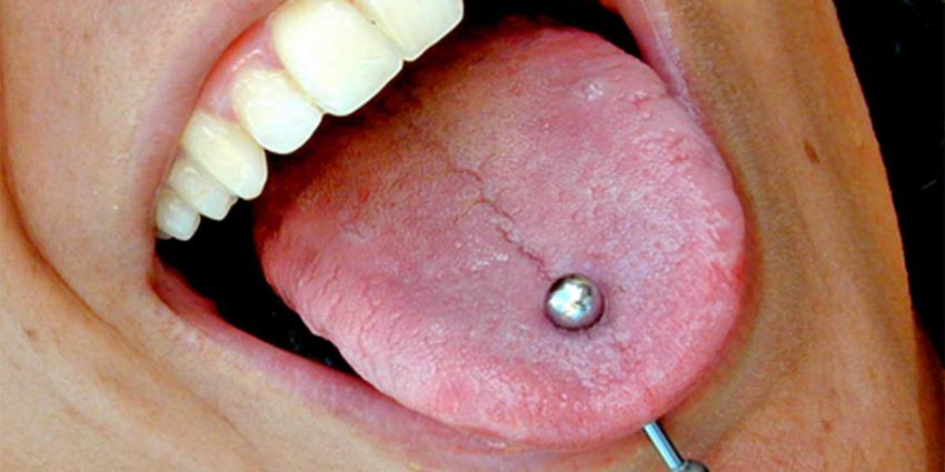 Mondpiercing niet bevorderlijk voor mondgezondheid