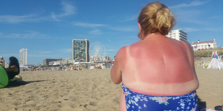 Zonkracht hoog, kans op verbranden groot 