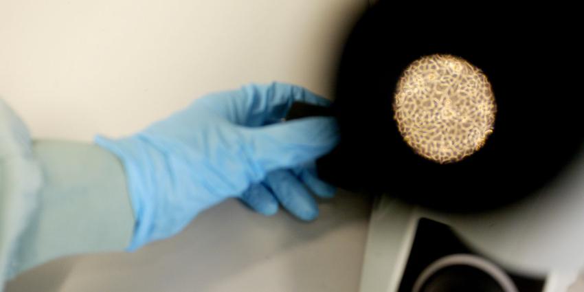 Dodelijke virus uitgebroken in Nigeria