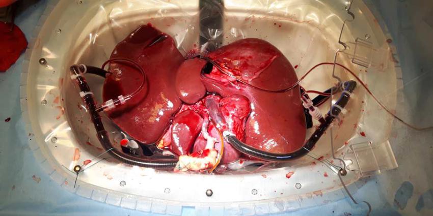 Nieuwe methodes om leverontsteking te diagnosticeren en behandelen