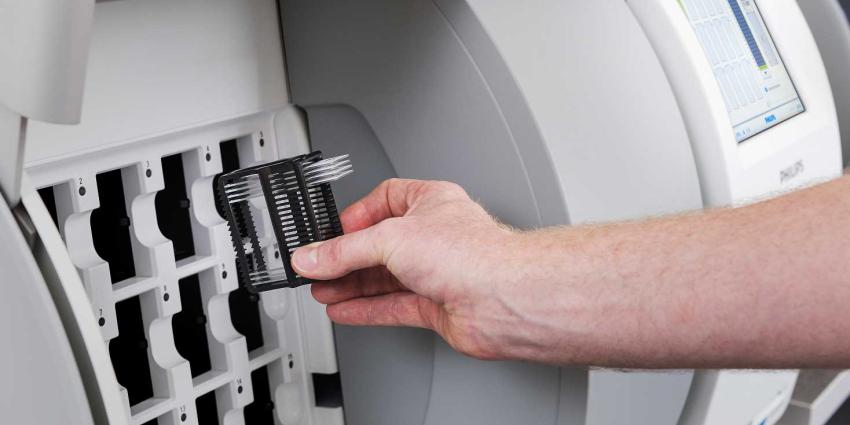 Patholoog stapt van microscoop over op digitale beelden voor diagnose