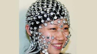 Onderzoek gestart met behandeling epilepsie met uitwendige elektroden