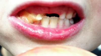 Te veel arsenicumgehalte in Nederlandse rijstproducten voor kinderen