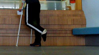 gebroken-been-ziekenhuis