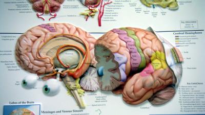 Hemodialyse kan doorbloeding hersenen verminderen