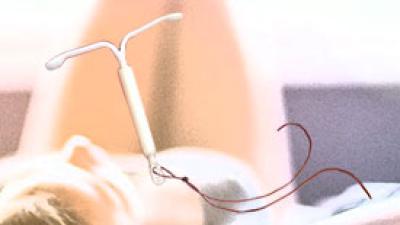 Hormoonspiraaltje verhoogt stressrespons